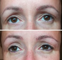 /album/fotogalerie/linky-pred-a-po-black-1-micro-2-jpg/